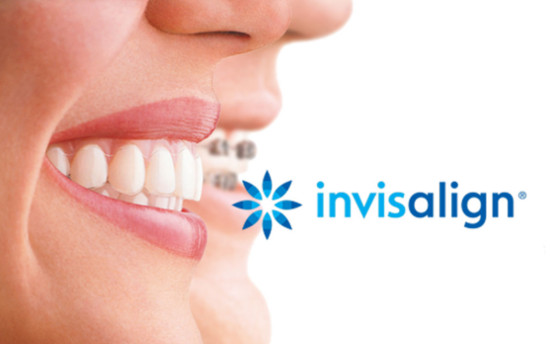 Igiene dentale professionale