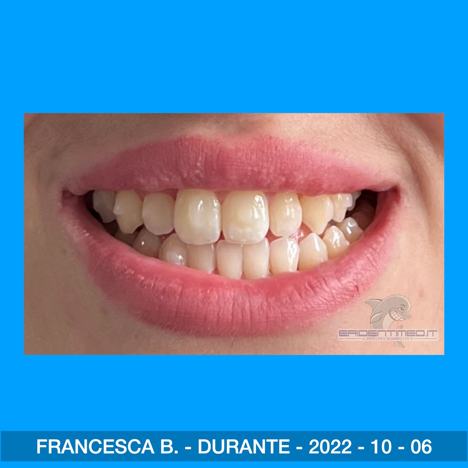 4216bf09-68b5-4739-aa89-a13f1c408bae.jpg