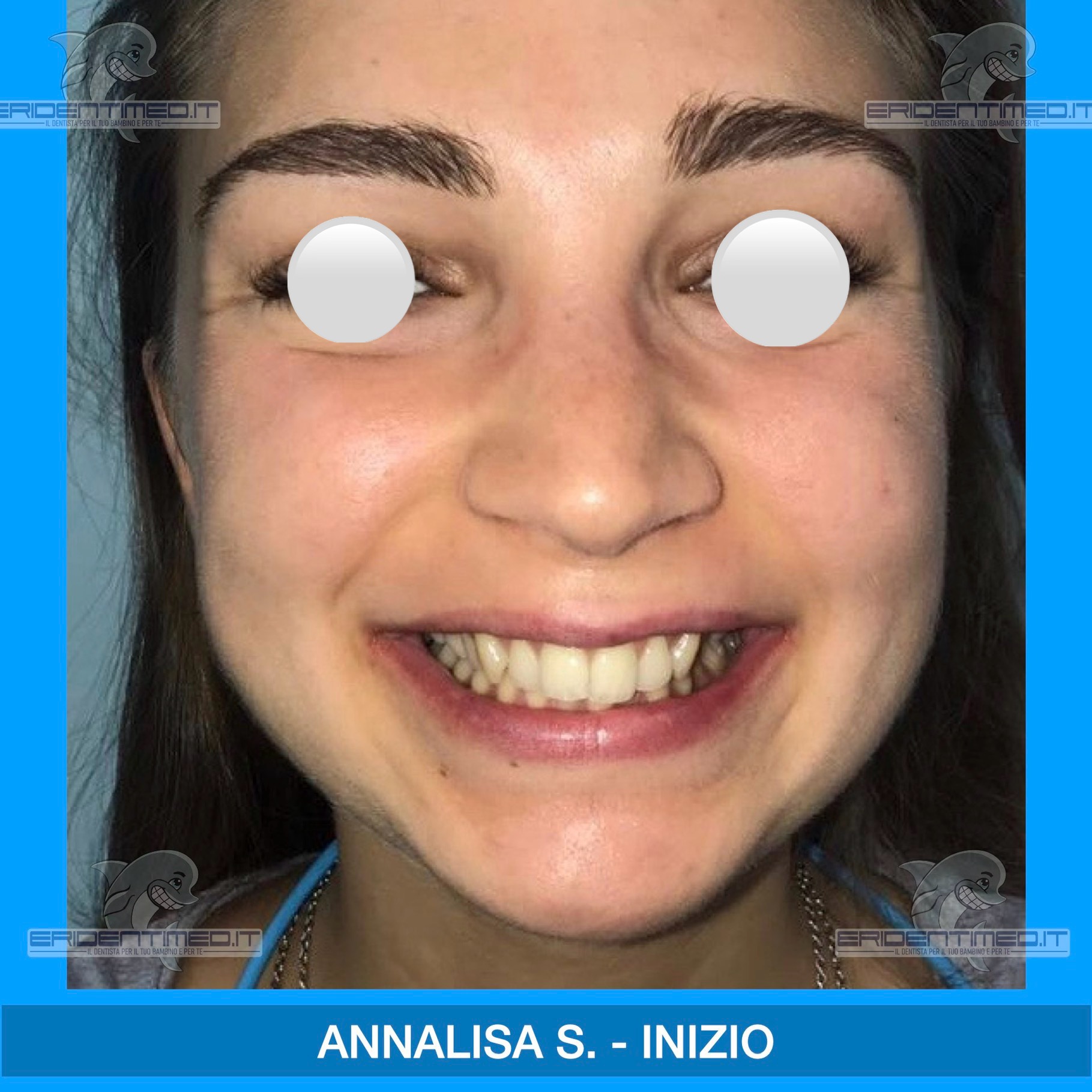 ‎PRIMA E DOPO COPIA copia.‎002.jpg