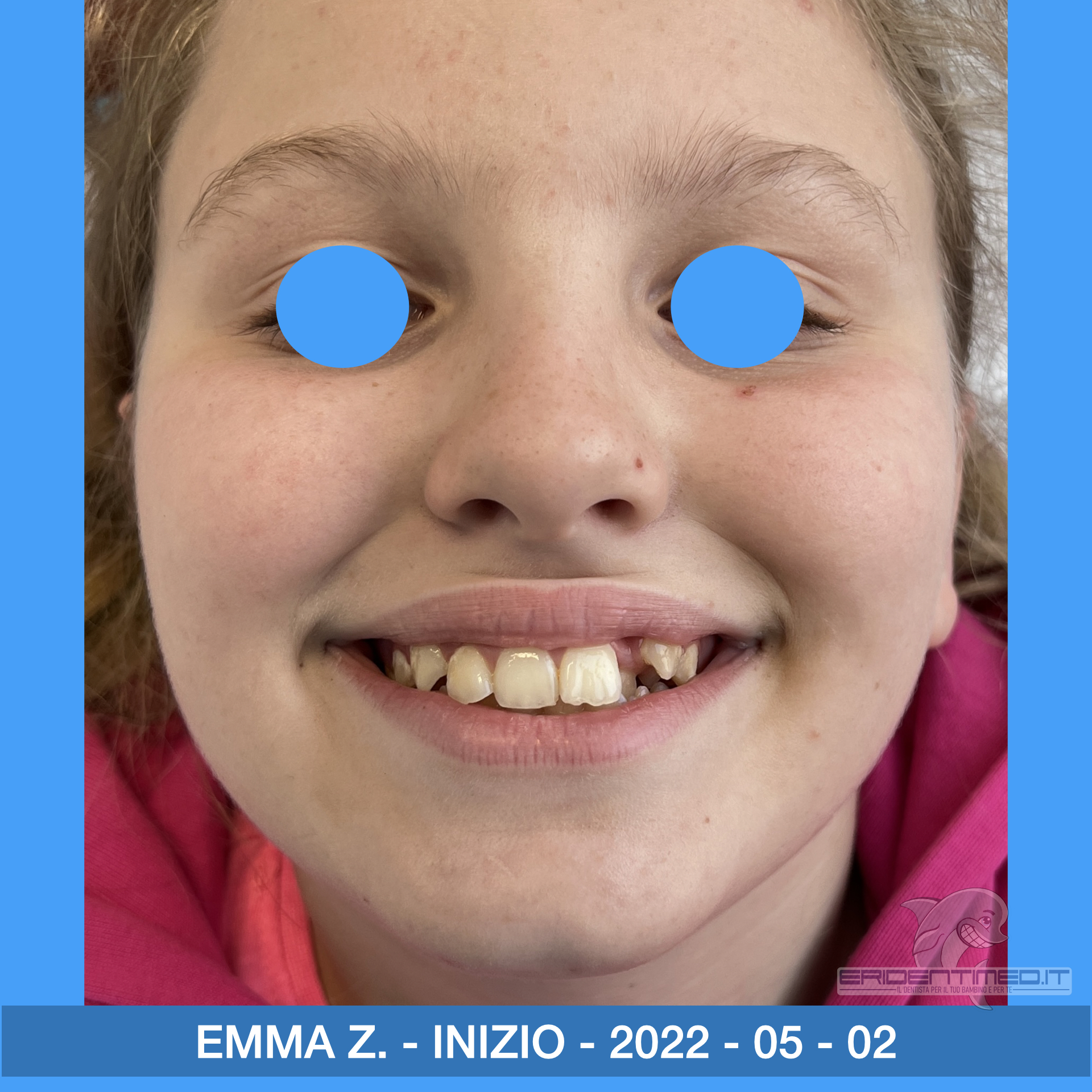 PRIMA E DOPO ZECCA EMMA.002.jpeg