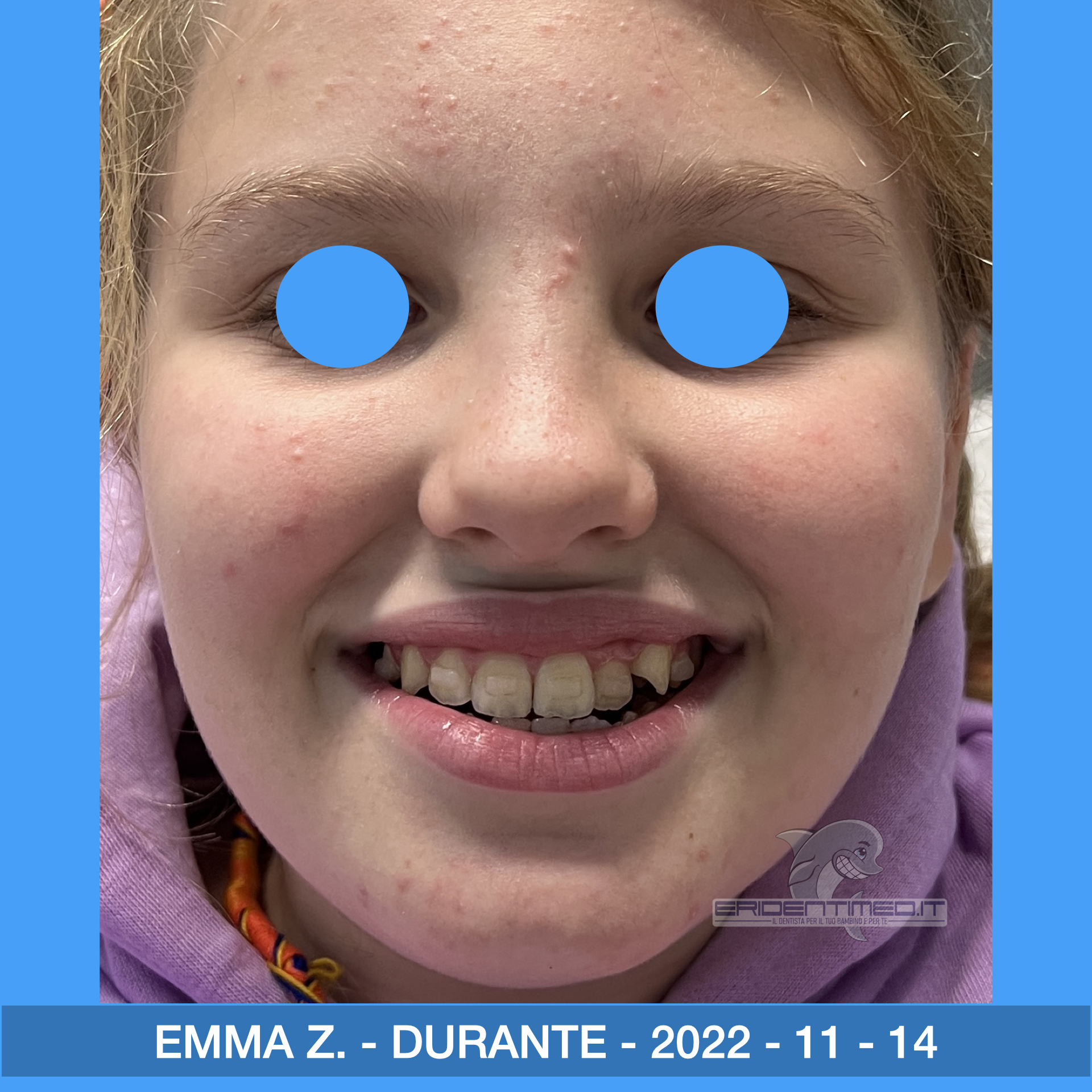 PRIMA E DOPO ZECCA EMMA.005.jpeg