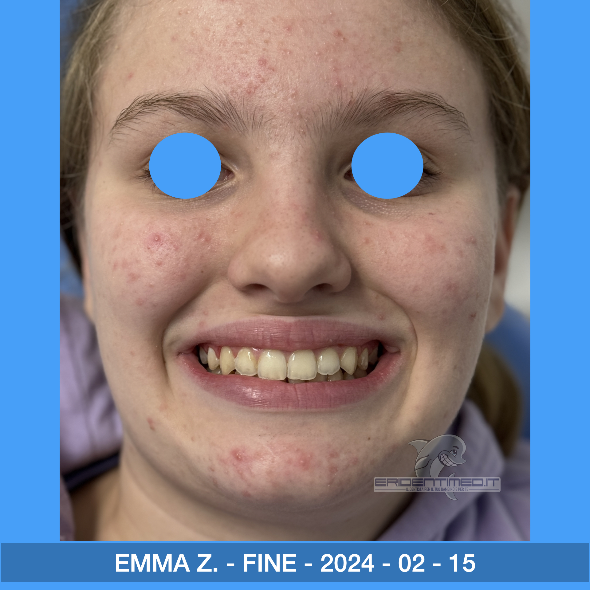 PRIMA E DOPO ZECCA EMMA.008.jpeg